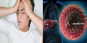 Nguyên nhân và triệu chứng bệnh viêm gan B